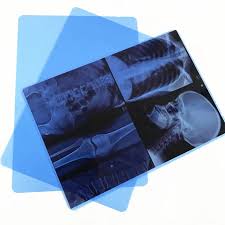 Ink-Jet X Ray Films 100 Sheets Per Packet A4.